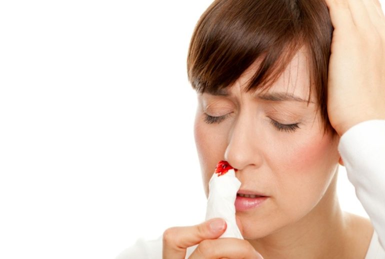 دکتر خونریزی بینی (اپیستاکسی) - مشهد