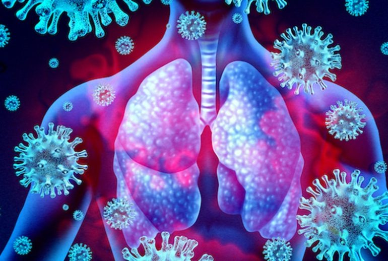 دکتر عفونت دستگاه تنفسی فوقانی - اصفهان