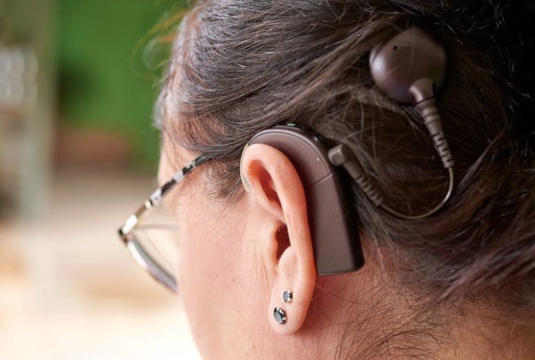 دکتر کاشت حلزون (AVT) - کرج